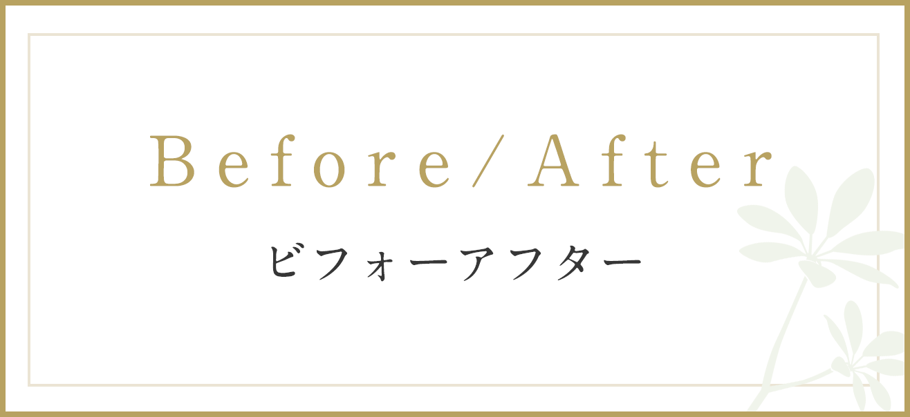 Before/After ビフォーアフター